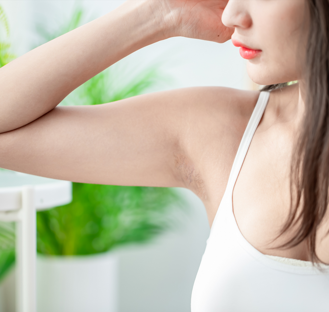 How to Prevent Razor Burns and Dark Spots from Shaving